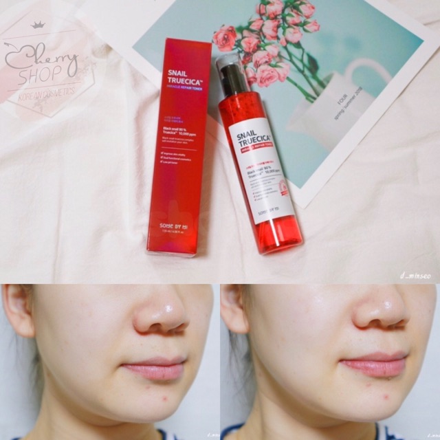 Nước hoa hồng Some By Mi Snail Truecica Miracle Repair Toner