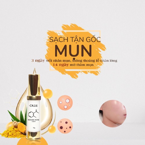 Kem ngừa mụn mờ thâm +Dr.LEE,mỹ phẩm chăm sóc da và làm đẹp hiệu quả