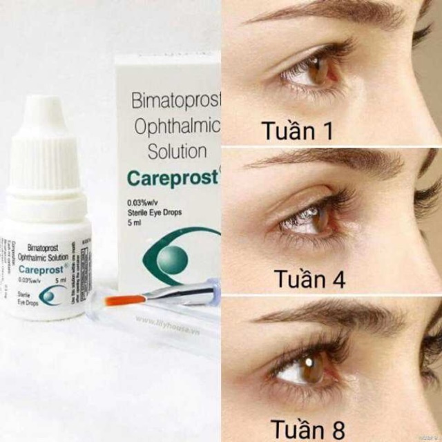 Mi Mọc Nhanh Bằng Thuốc Dài Mi Ấn Độ Careprost