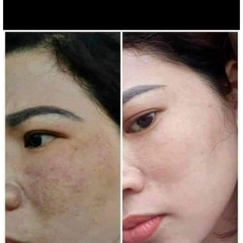 Kem Ngày Dakami K-White Chính Hãng Mua 2 Tặng 1
