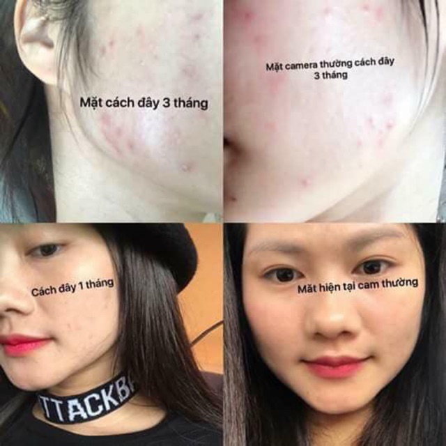 Serum Vitamin C Ava trắng da