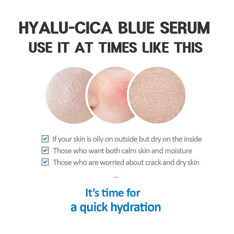 Serum chăm sóc da SKIN1004 Madagascar Centella Hyalu-Cica Blue 30ml / 50ml