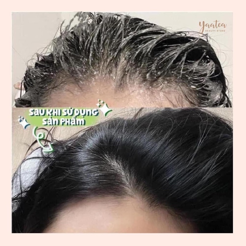 Dầu Gội Tẩy Tế Bào Chết Da Đầu Làm Sạch, Kích Thích Mọc Tóc Café Mimi Shampoo Scrub