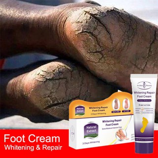 [Hàng mới về] Kem dưỡng da chân chống nứt nẻ chống khô tiện dụng thumbnail