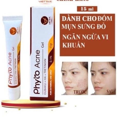 Gel Hỗ Trợ Giảm Mụn, Tăng Sinh Collagen Phyto Acne Oubaku + HA + Tretinoin Gel