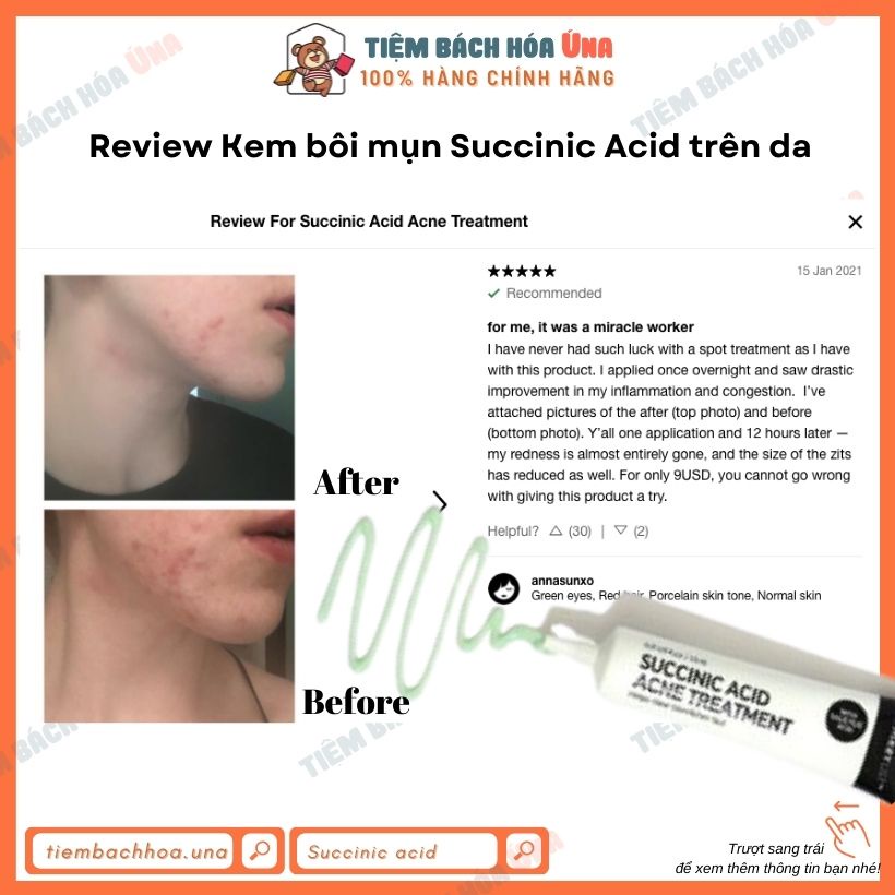 [New] Kem bôi lên mụn The inkey list SUCCINIC ACID và MANDELIC ACID acne treatment 15ml