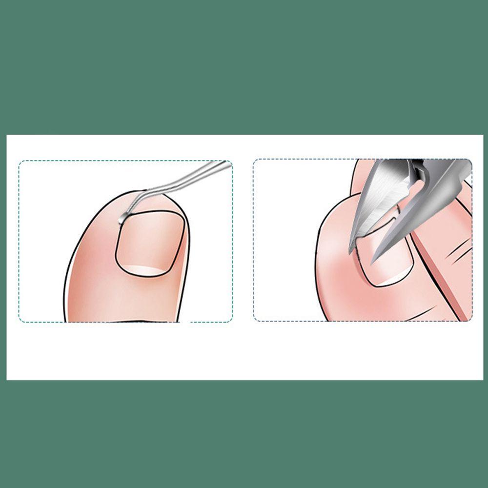 Kềm Cắt Tỉa Da Chết Móng Chân Malcom Ingrown Chuyên Nghiệp Đa Năng