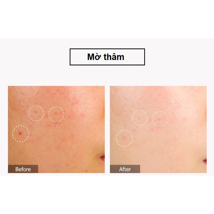 Nước Hoa Hồng Dưỡng Trắng, Se Khít Lỗ Chân Lông Tiam My Signature Vita Red Toner | BigBuy360 - bigbuy360.vn