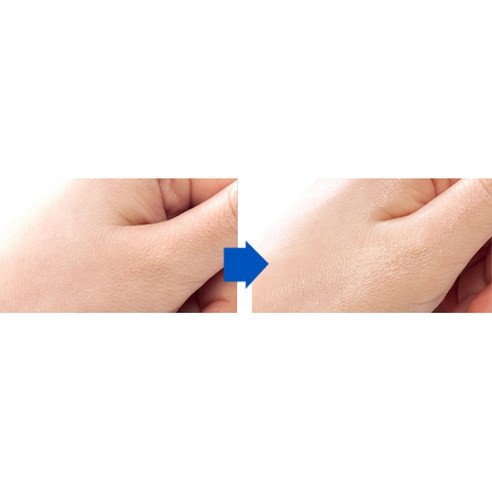 Kem Dưỡng Ẩm Enprani Super Aqua Cream