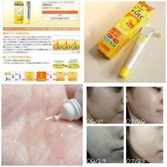 Serum Vitamin C Melano CC Rohto sáng da, mờ nám, tàn nhang | BigBuy360 - bigbuy360.vn