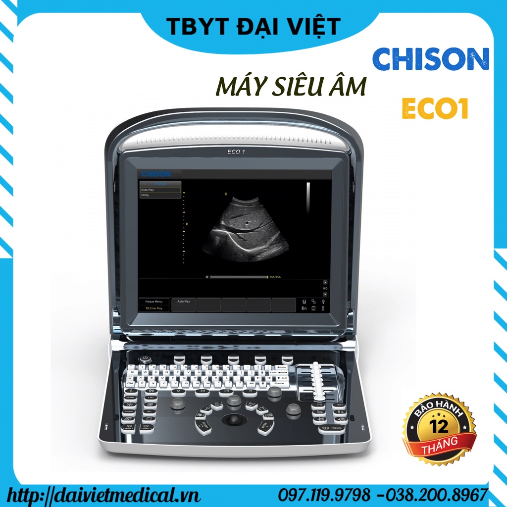 MÁY SIÊU ÂM CHISON ECO1 CHÍNH HÃNG BẢO HÀNH 12 THÁNG