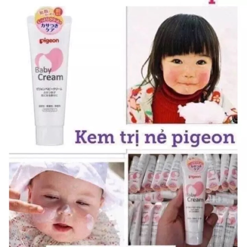 Kem chống nẻ, dưỡng ẩm cho bé từ sơ sinh Pigeon 50g Nhật bản