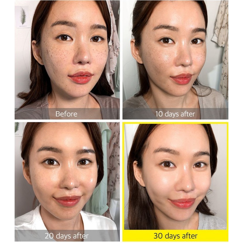 Combo 2 Sản Phẩm Dưỡng Ẩm, Trắng Da Chiết Xuất Quả Thanh Yên Some By Mi Yuja Niacin 30 Days (Serum 50ml + Kem 100ml)