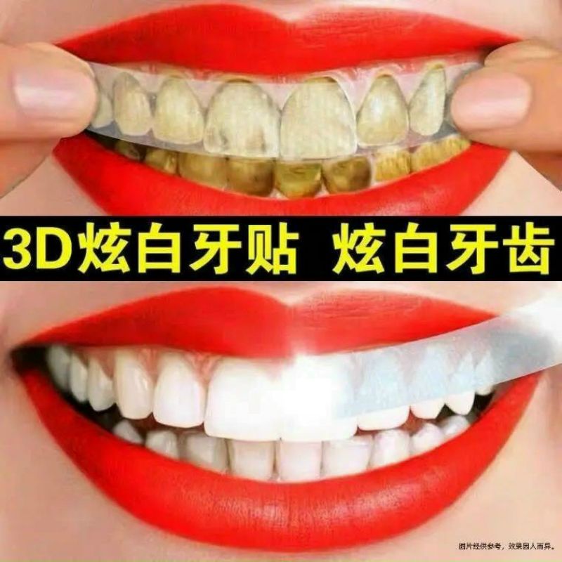 Hộp 7 Gói 2 miếng dán trắng răng tiện lợi 3D White Teeth Whitening Strips