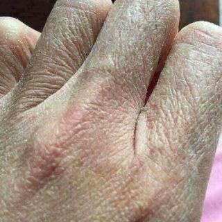 [CHÍNH HÃNG] Vaselin Kem nẻ viện bỏng