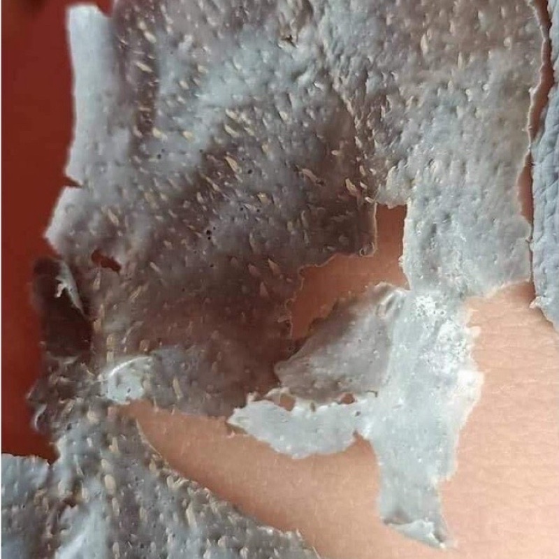 Lột Mụn Đầu Đen Dr acne | BigBuy360 - bigbuy360.vn