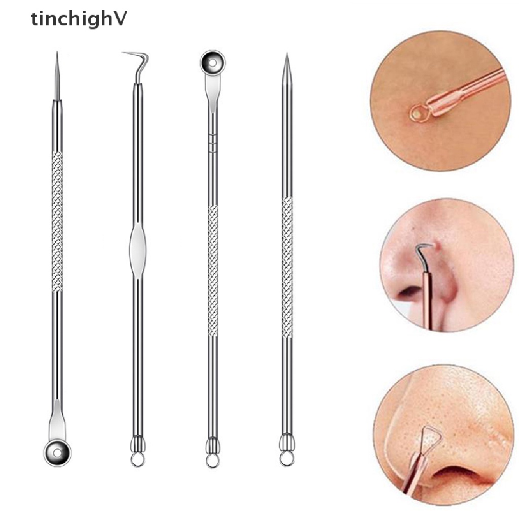 Bộ 4 Dụng Cụ Loại Bỏ Mụn Đầu Đen Chăm Sóc Da Mặt