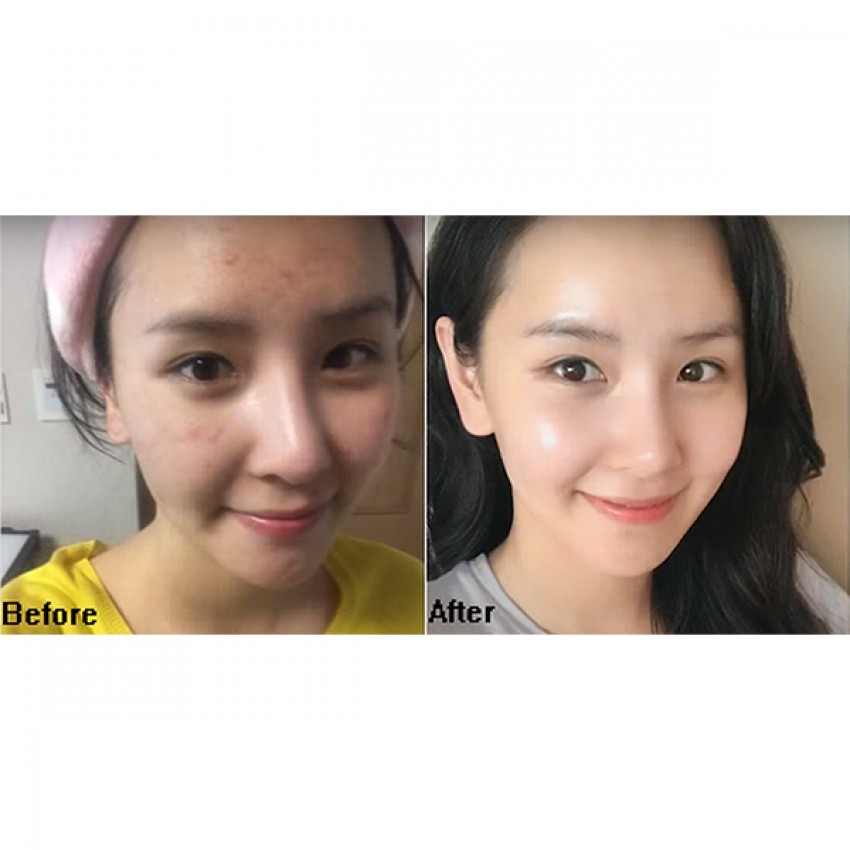 [BILL MỸ] Tẩy Tế Bào Chất The Ordinary Lactic Acid 5%, 10% + HA 2% Cấp Ẩm, Dưỡng Da Sáng Mịn 30 ml [SeeMe beauty]