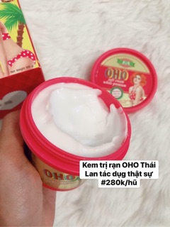 Kem trị rạn da OHO