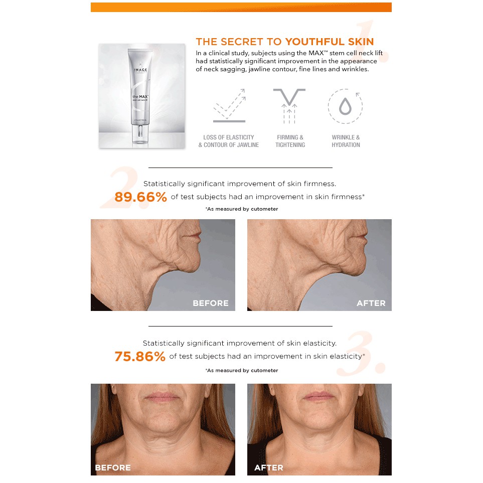 Kem săn chắc vùng cổ và ngực Image Skincare The MAX Stem Cell Neck Lift 59ml | WebRaoVat - webraovat.net.vn