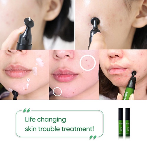 Tinh chất vitamin E chăm sóc da 10ml