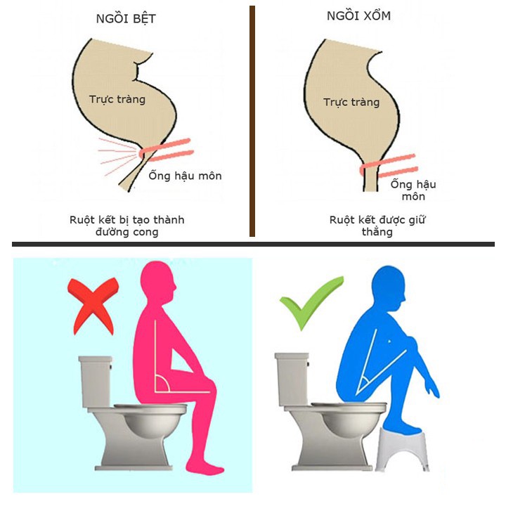 Ghế Kê Chân Bồn Cầu Toilet Notoro INOCHI Cho Trẻ Em Và Người Lớn - Chống Táo Bón, Đi Vệ Sinh Đúng Cách