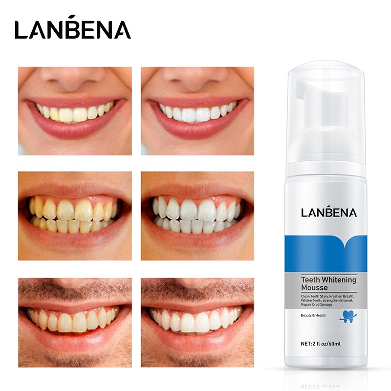 Kem đánh răng Lanbena làm trắng răng 60ml chất lượng cao
