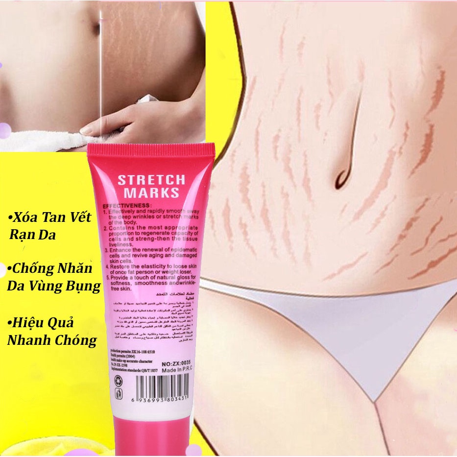 Kem Massage Chống Rạn Da Vùng Bụng Và Chống Nhăn Toàn Thân Phục Hồi Vết Sẹo Mang Thai STRETCH MARKS