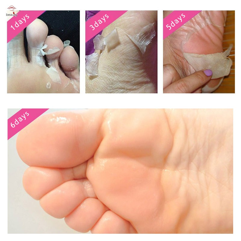 #Quan tâm# Exfoliating Peel Foot Mask Baby Soft Feet Remove Hard Dead Skin Callus Feet Care