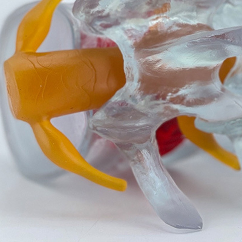 Blg Đĩa Mô Hình Di Sản Đĩa Thắt Lưng Có Thể Di Chuyển Được Di Chuyển Được Cho Lối Đi Đường Đi Thông Thường Và Ner