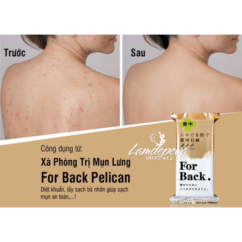 Xà phòng FOR BACK ngừa mụn lưng, viêm nang, giúp trắng da mịn màng | BigBuy360 - bigbuy360.vn