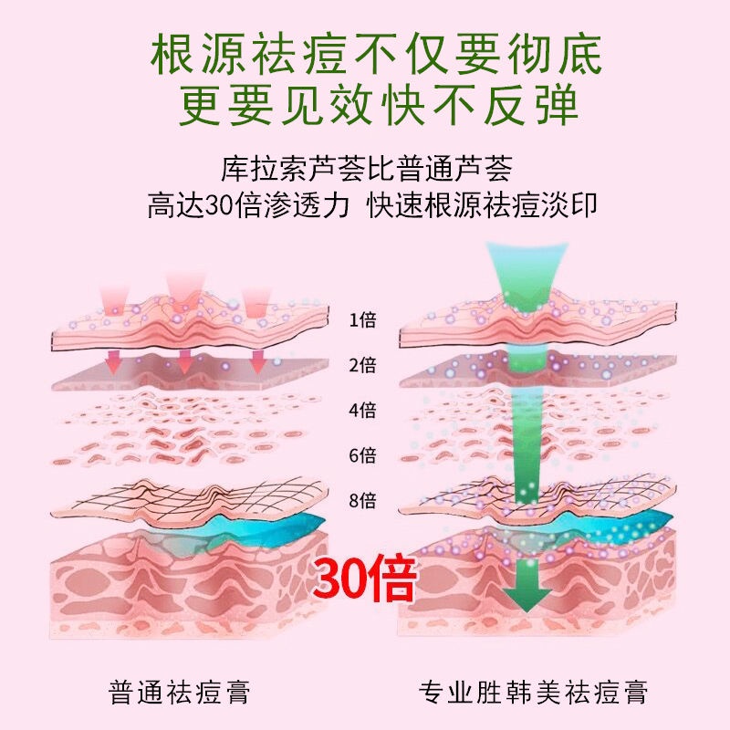 Kem Trị Mụn 20Gmaanshanzanzc.My11.27 Chuyên Dụng Chất Lượng | BigBuy360 - bigbuy360.vn