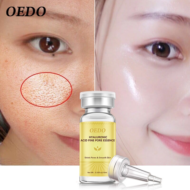 Tinh Chất Hyaluronic Acid Dưỡng Ẩm Se Khít Lỗ Chân Lông Chống Lão Hóa Và Nếp Nhăn 10ml