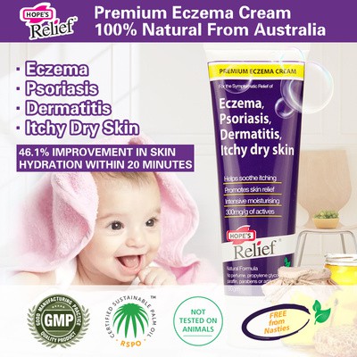 Kem điều trị Eczema, vẩy nến, viêm da Hopes Relief 60g Của Úc