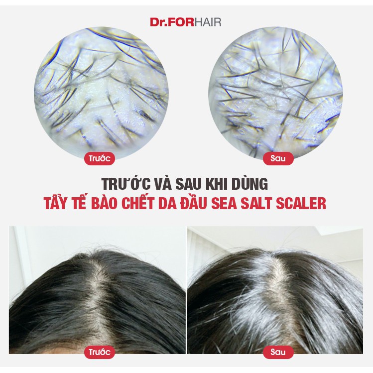 Bộ Muối biển tẩy tế bào chết da đầu 300g, dầu xả 250ml Dr.FORHAIR/Dr For Hair giảm gàu, dưỡng tóc mượt