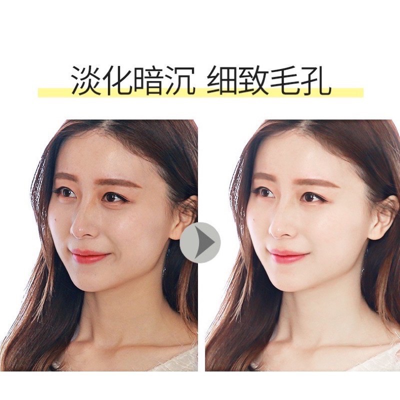 Serum dưỡng da mặt căng bóng từ nhân sâm hàng nội địa Trung dành cho mọi loại d - ngừa lão hóa da, cung cấp độ ẩm cho da | BigBuy360 - bigbuy360.vn