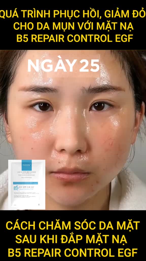 (NEW) Mặt Nạ Cấp ẩm Phục Hồi Da Yuejin B5 Repair Control EGF 25ml | BigBuy360 - bigbuy360.vn