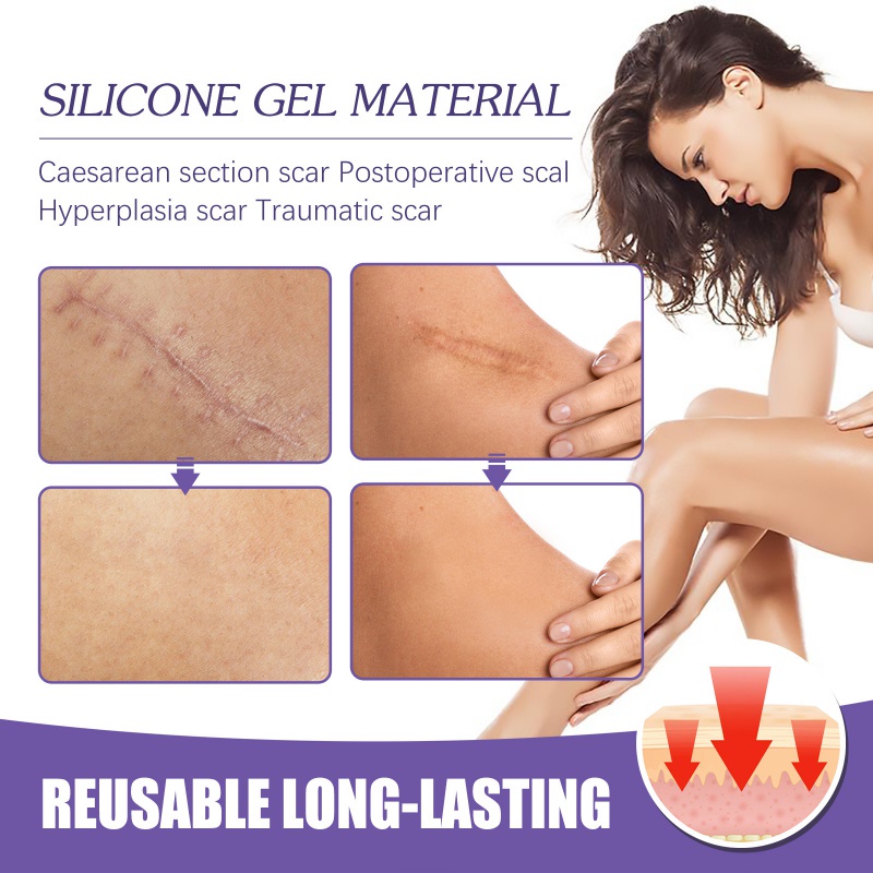 1 Cuộn Băng Dán Hỗ trợ giảm sẹo Bằng Silicone Tiện Dụng