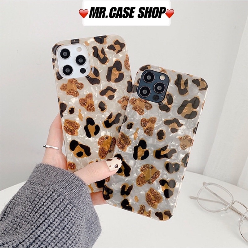 Case iPhone Da Beo Dẻo Dành Cho 12Promax/12/11Promax/Xsmax/X/Xs/7Plus/8Plus  - Mr.CAse
