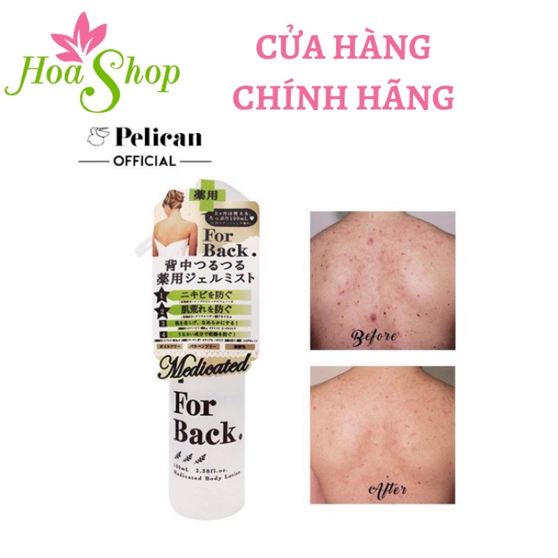 Xịt mụn lưng For Back Body Lotion 100ml