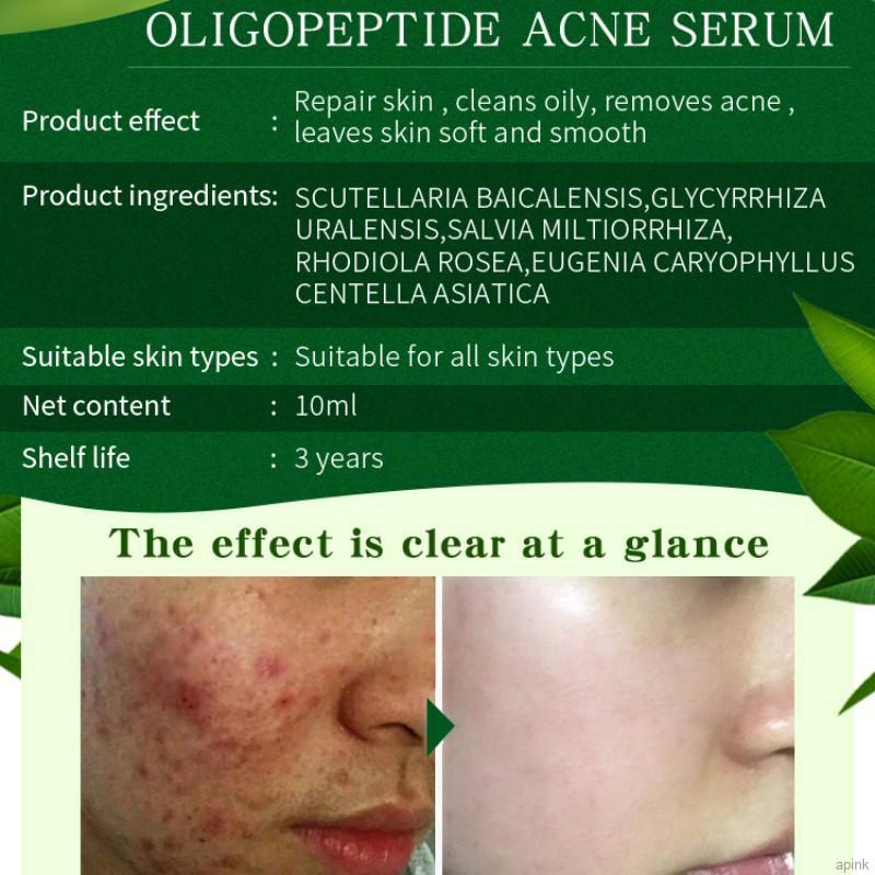 [Hàng mới về] Tinh Chất Oligopeptide Giảm Mụn Dưỡng Ẩm Làm Mịn Da Hiệu Quả