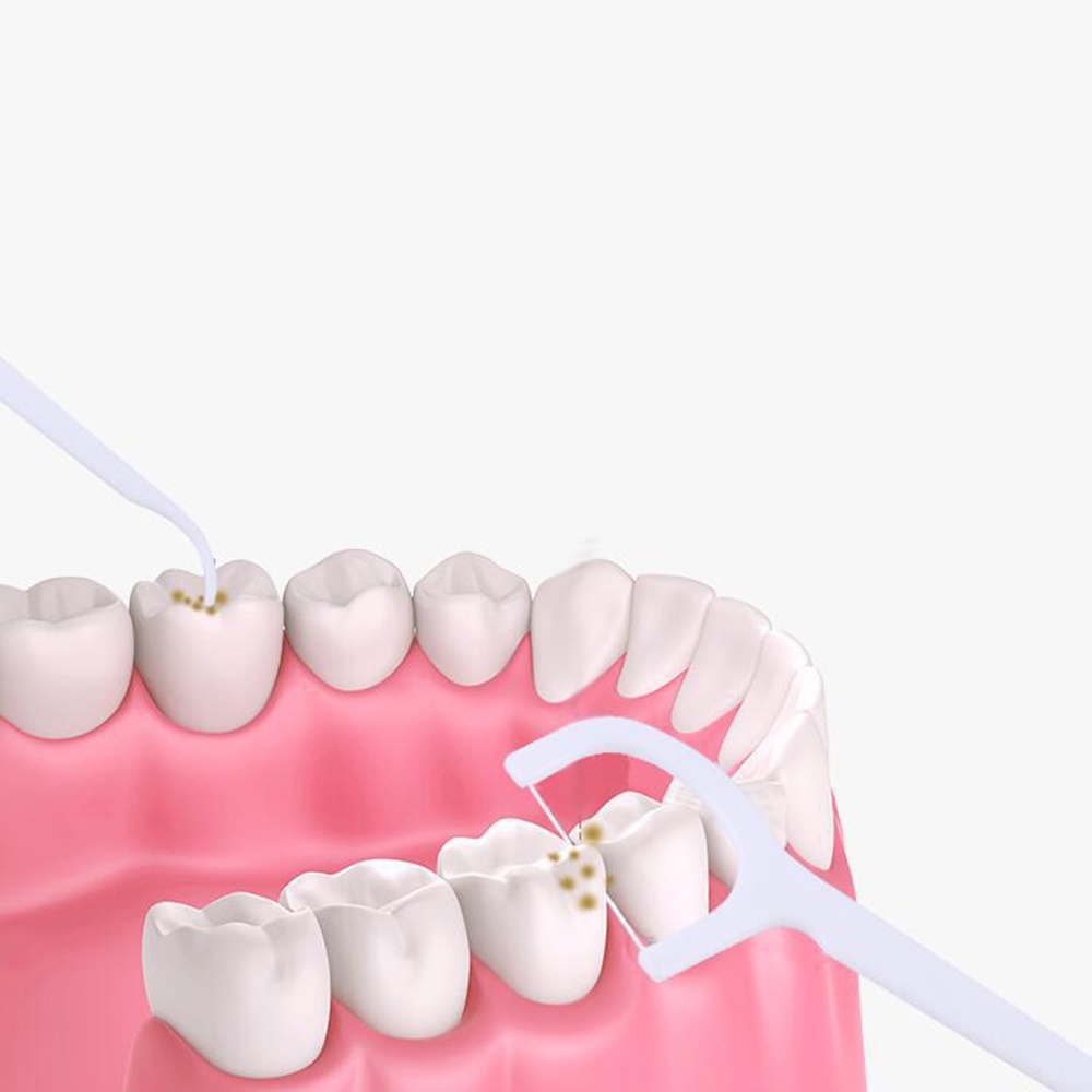 [Hàng mới về] Set 100 tăm chỉ dùng một lần tiện dụng cho nha khoa