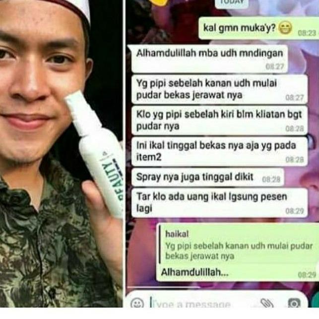 Cái thứ hai này! Tấm trải giường phun sương làm đẹp Lr075 Natura NBS Beuty Biuty Sprey Natura | BigBuy360 - bigbuy360.vn