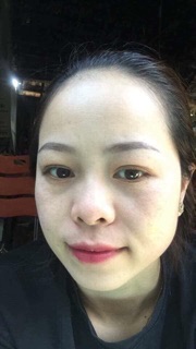 Combo trị nám / tàn nhang tận gốc detox blanc