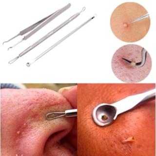 Set 3 Cây Nặn Mụn Bằng Thép Không Gỉ Tiện Dụng