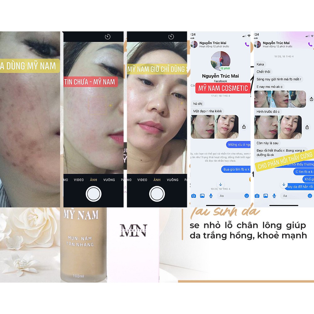 Combo Cải Thiện Mụn Siêu Tốc Mỹ Nam - Cải Thiên Tận Gốc Mụn, Thâm Nám, Tàn Nhang, Sẹo Rỗ