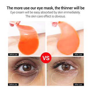 Mặt nạ mắt LANBENA dạng thạch chứa vitamin C và collagen giúp dưỡng ẩm làm sáng quầng thâm và ngăn ngừa nếp nhăn 60 cái