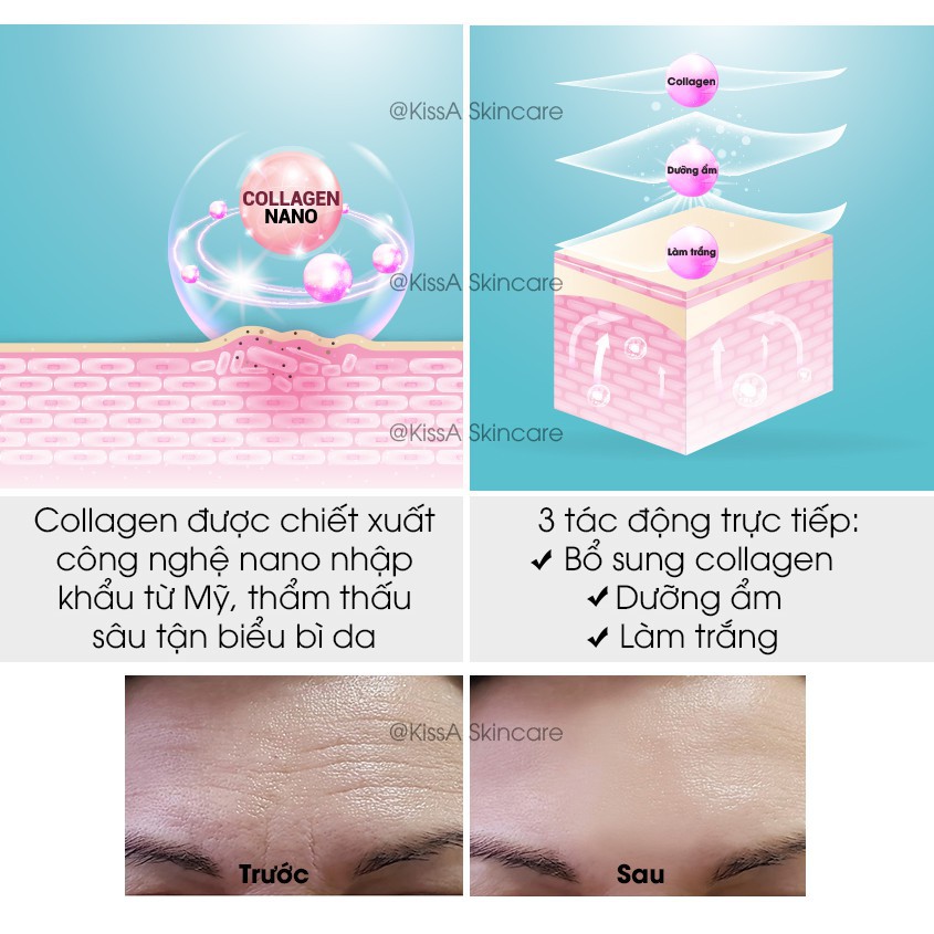 Kem Dưỡng Trắng Da Collagen KissA 15g