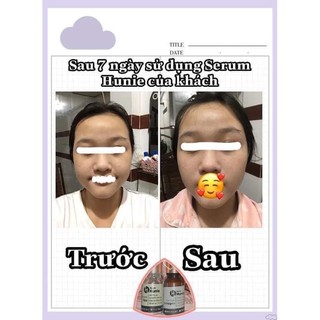 Serum Face Collagen Hunie