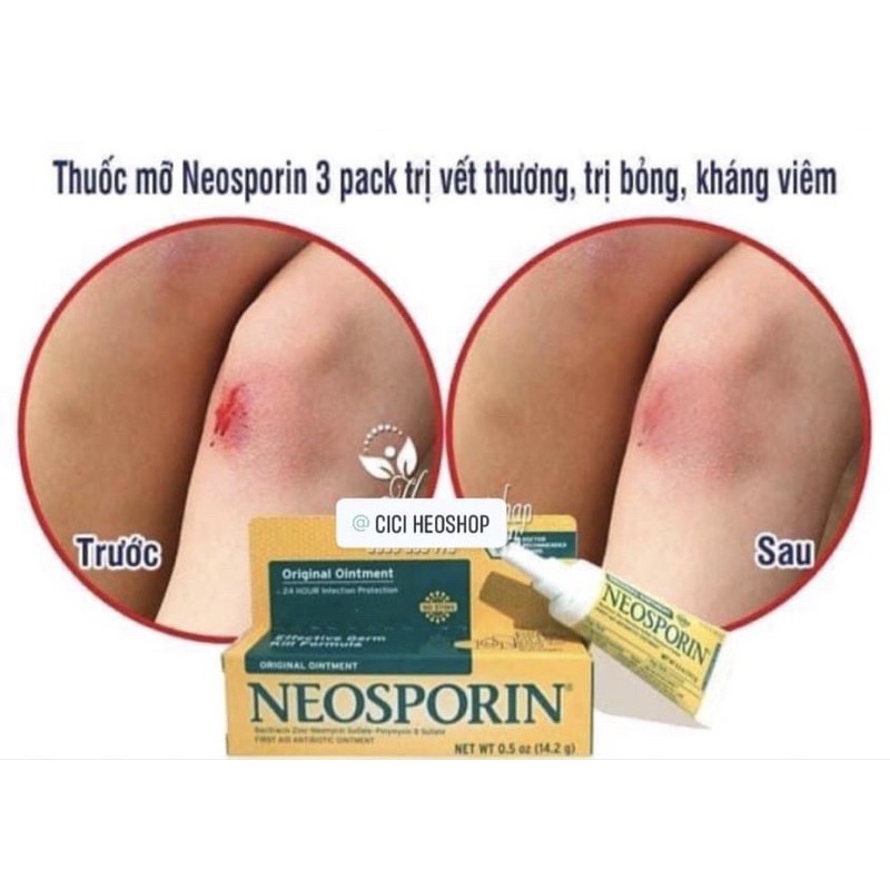 NEOSPORIN KEM TRỊ SẸO TRỊ BỎNG TRỊ VẾT THƯƠNG HỞ THẦN THÁNH